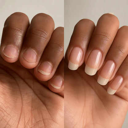 Aceite para el crecimiento de uñas