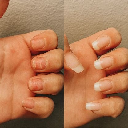 Aceite para el crecimiento de uñas